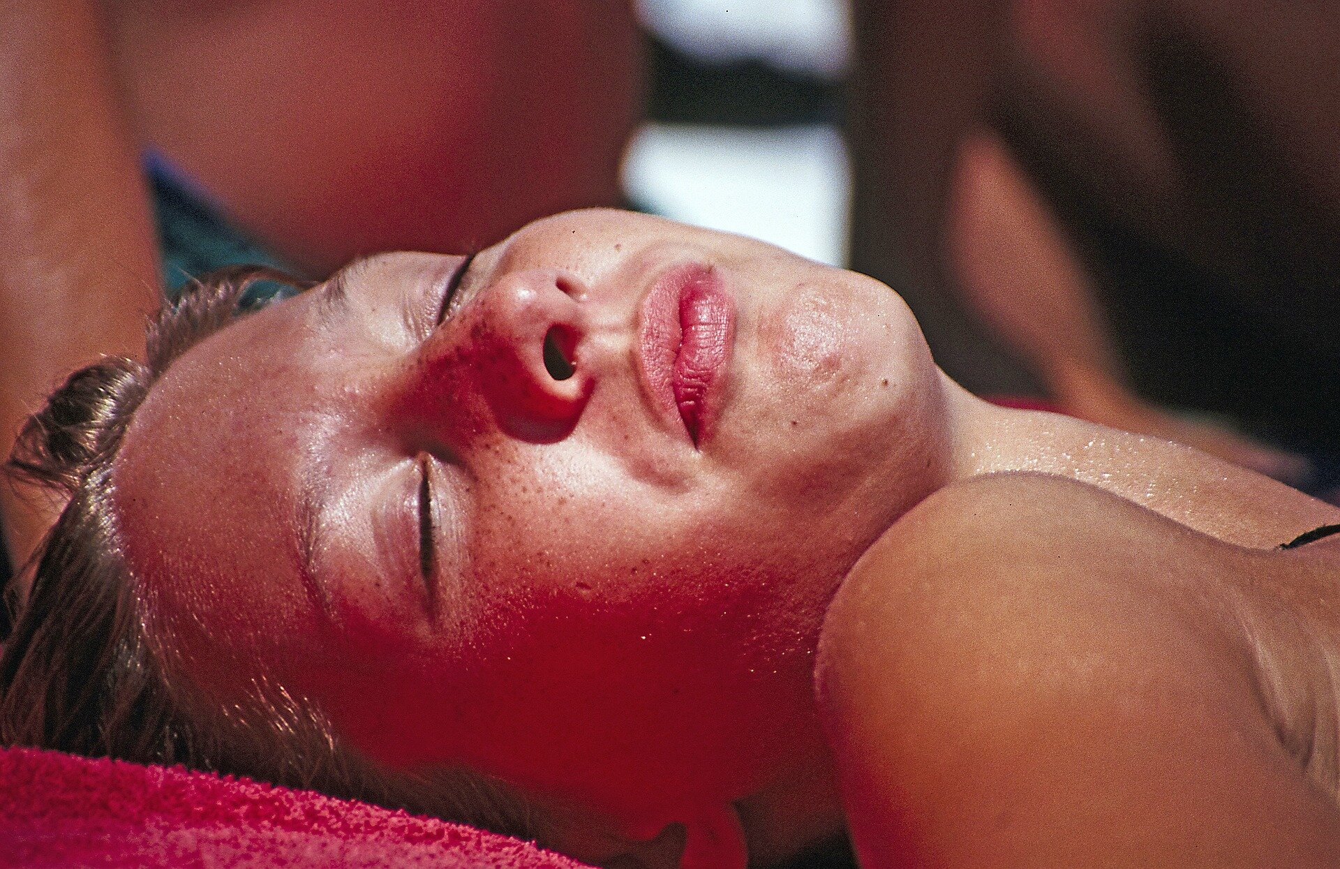 Great sunburn relief and remedies